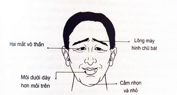 Đàn ông miệng túm số khổ
