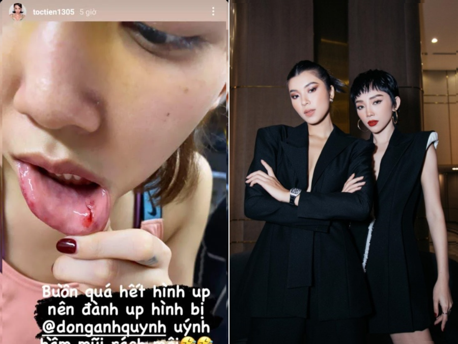 Mới đây, Tóc Tiên lại một lần nữa trở thành nạn nhân của người mẫu Đồng Ánh Quỳnh. Cô đăng ảnh 