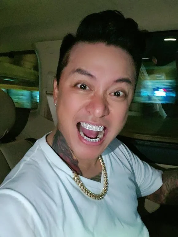 Tuấn Hưng vừa khoe hình ảnh hàm răng được bọc bằng kim cương có giá lên đến gần 1 tỷ đồng. Trong showbiz Việt, rapper Binz cũng từng đeo hàm răng đính kim cương có giá trị khủng dự lễ cưới Tóc Tiên. Tuấn Hưng đã chia sẻ: