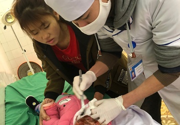 Tai nạn khiến vùng mặt của các bé bị bỏng nặng. Ảnh: Sở Y tế Lào Cai.  