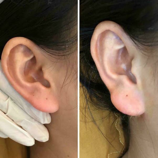 Trào lưu làm tai Phật