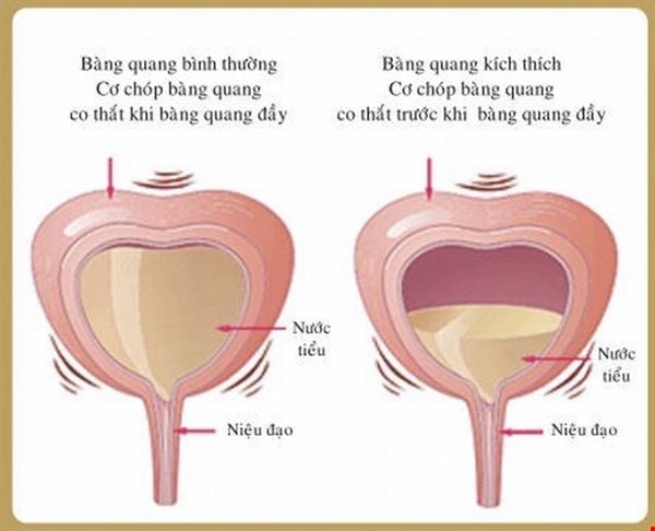 hoi-chung-bang-quang-kich-thich