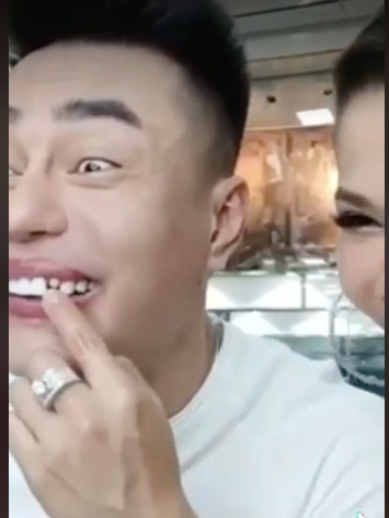 Mới đây, khi đang livestream trò chuyện, Lê Dương Bảo Lâm bất ngờ bị gãy răng: 