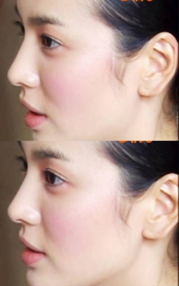 Đây chính là bức ảnh gây