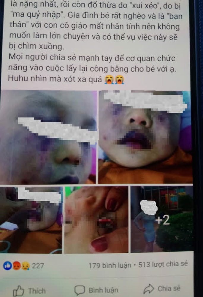 Nhiều cư dân mạng chia sẻ hình ảnh nghi vấn em bé bị đánh (Ảnh: NLĐ)