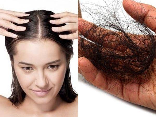 Tóc bạc sơm do gen di truyền hoặc bệnh nan y