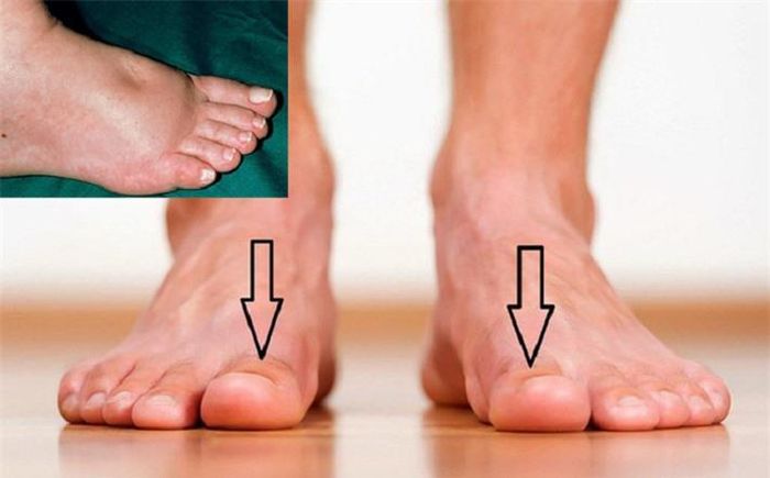 Nếu thấy chân có dấu hiệu đau hoặc sưng, có thể đó là dấu hiệu cảnh báo chức năng thận có vấn đề