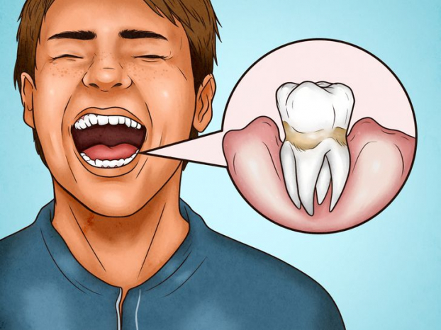 Đi kiểm tra nếu thấy phần chân răng không được sáng,, thường xuyên bị chảy máu