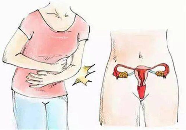 Dấu hiệu bệnh u nội mạc tử cung
