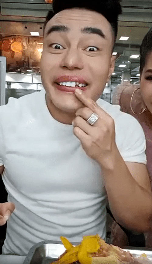 Sao Việt và những lần muốn độn thổ vì sự cố răng miệng: Trang Trần và Lê Dương Bảo Lâm bị rơi răng