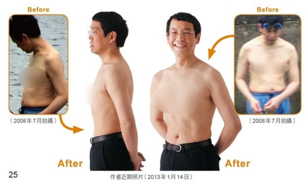 Hình ảnh bác sĩ Masashi Kawamura chia sẻ trước và sau khi thực hiện phương pháp 