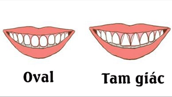 xem-tuong-rang-cua