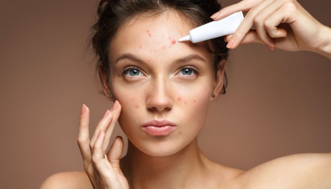 skincare-routine-for-acne-pron-8046-1839-1645430369-1645501544033-1645501544504744858584