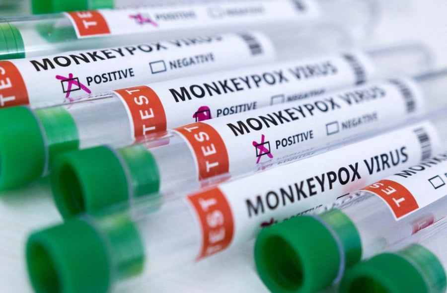  Tìm thấy mảnh ADN của virus gây bệnh đậu mùa khỉ trong tinh dịch nam giới. 
