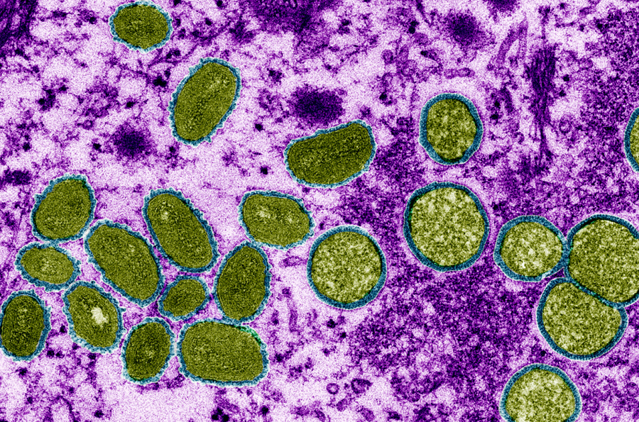 Virus đậu mùa khỉ - Ảnh: CDC/SCIENCE
