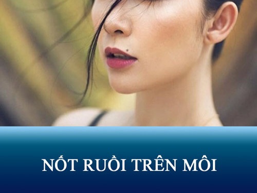 not-ruoi-01