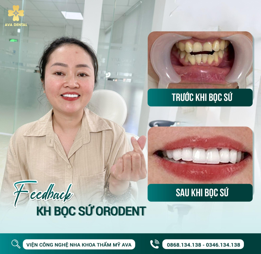 Feedback khách hàng bọc răng sứ Orodent