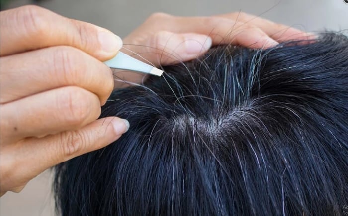 Thói quen nhổ tóc bạc, tóc sâu không chỉ không giải quyết được tình trạng ngứa mà còn có thể gây hại cho da đầu và nang tóc.