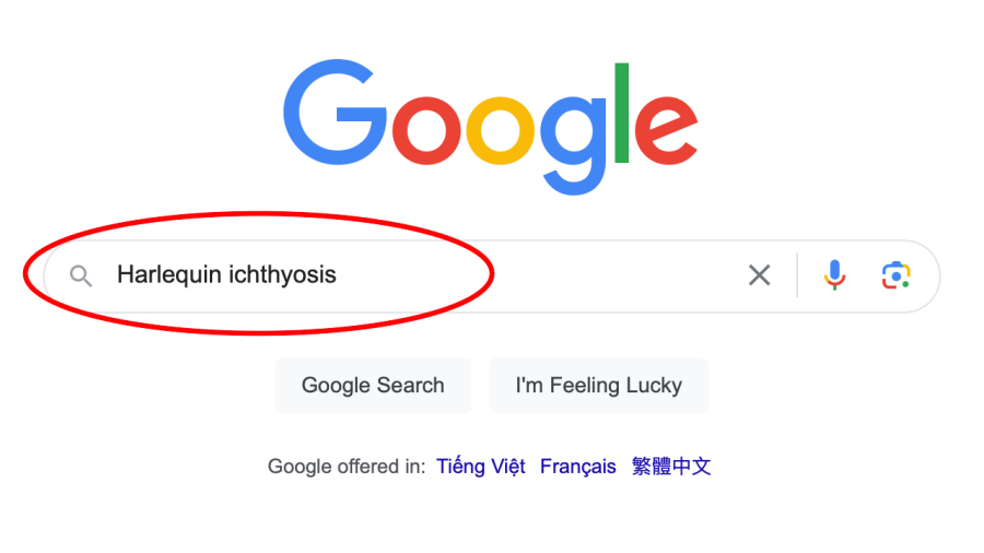 Harlequin ichthyosis là một từ khoá mà bạn không nên tìm kiếm trên Google.