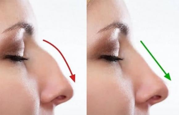 Thực tế, phụ nữ với chiếc mũi to thường được tôn vinh trong nghệ thuật và văn hóa. 