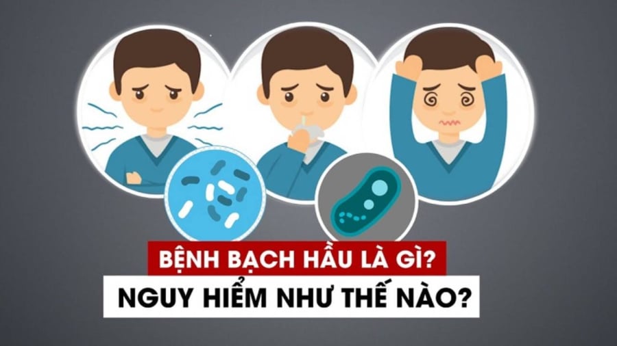 Bạch hầu là một bệnh truyền nhiễm dễ lây lan qua nhiều hình thức khác nhau, phổ biến nhất là qua đường hô hấp