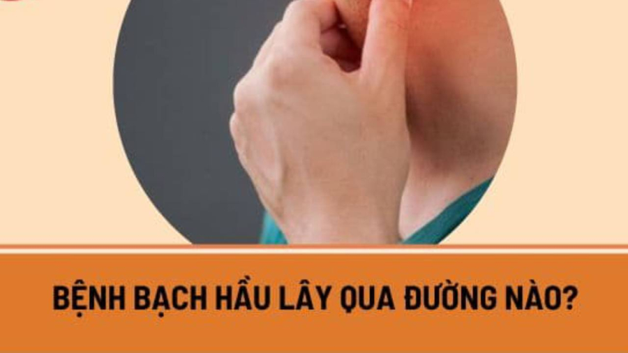 Bệnh bạch hầu ʟȃy qua ᵭường hȏ hấp, cũng có thể ʟȃy qua tiḗp xúc với da của người mắc bệnh và gián tiḗp qua ᵭṑ dùng...