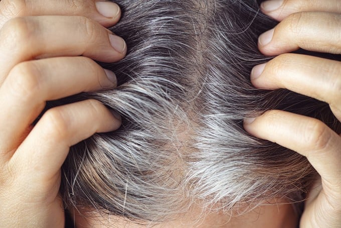Thiếu ngủ, căng thẳng kéo dài cũng làm gia tăng tình trạng bạc tóc.

