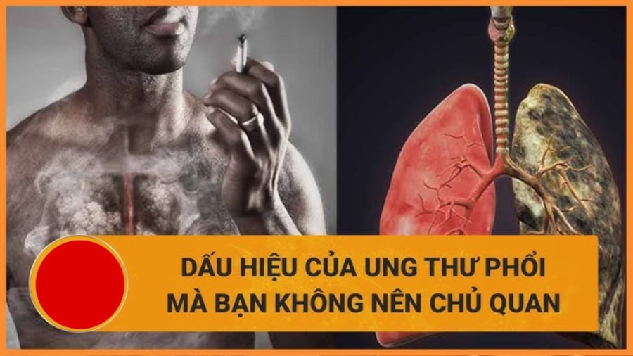 Thói quen mở ᵭường cho K tấn cȏng