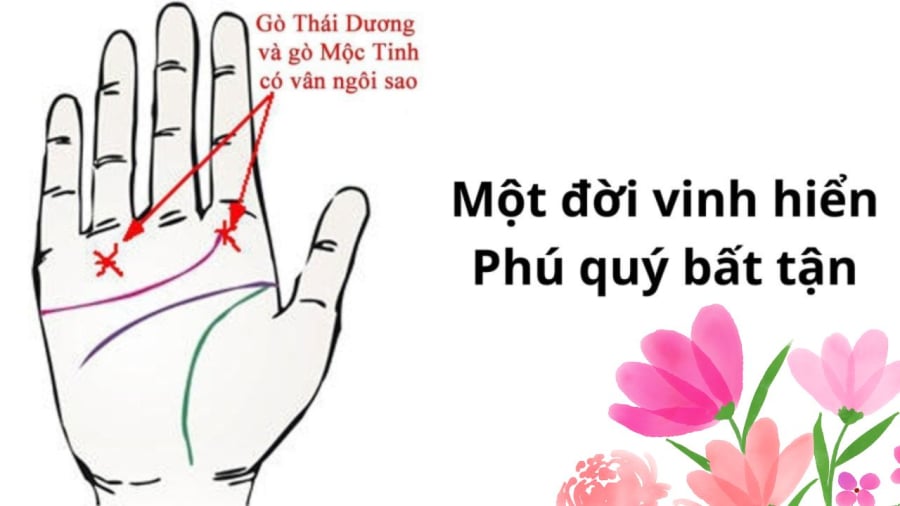 Biểu hiện của sự giàu có