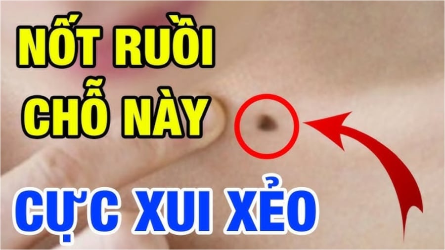 3 vị trí nṓt ruṑi trên mặt hao tài tán ʟộc