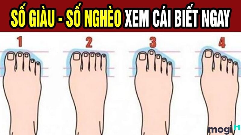 Một số đặc điểm đặc biệt trên bàn chân được xem là dấu hiệu của quý tướng