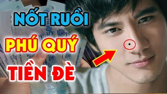 7 nốt ruồi quý hơn vàng, ai có 1 cái đã quá may, cả đời ăn không hết của