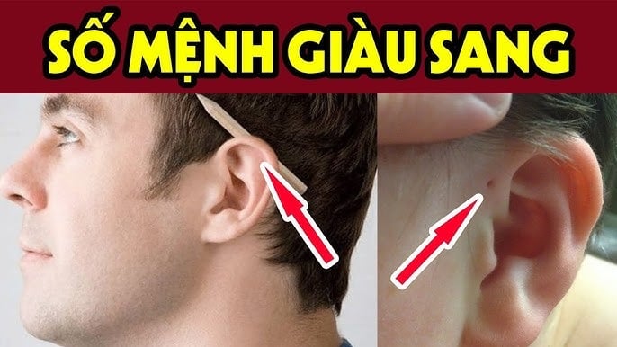 7 nốt ruồi Thần Tài 'đánh dấu', số son vận đỏ, ai có 1/7 cái cũng tha hồ hưởng