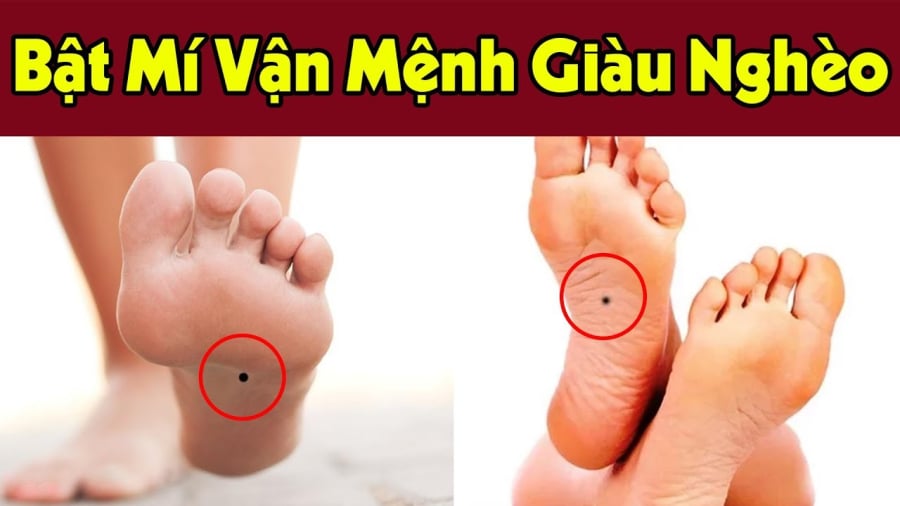 Tướng bàn chân được cho là mang đến vận may, sự giàu sang phú quý