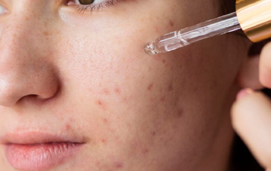 retinol1-0902.jpg
