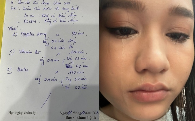 Cô bị rạn da do tăng cân đột ngột, tóc rụng khiến cô phải cắt ngắn