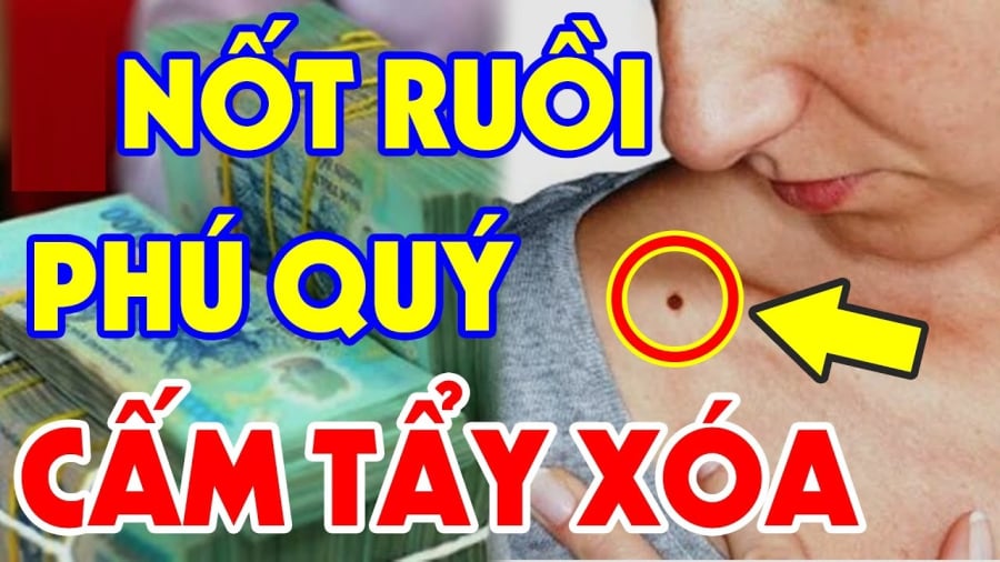 4 nốt ruồi phú quý nhiều người 