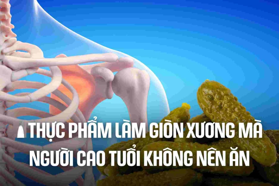 3 loại nước là 'vua rút cạn canxi, uống nhiều xương giòn, dễ gãy