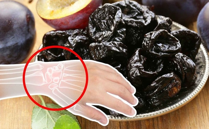 3 loại nước là 'vua rút cạn canxi, uống nhiều xương giòn, dễ gãy