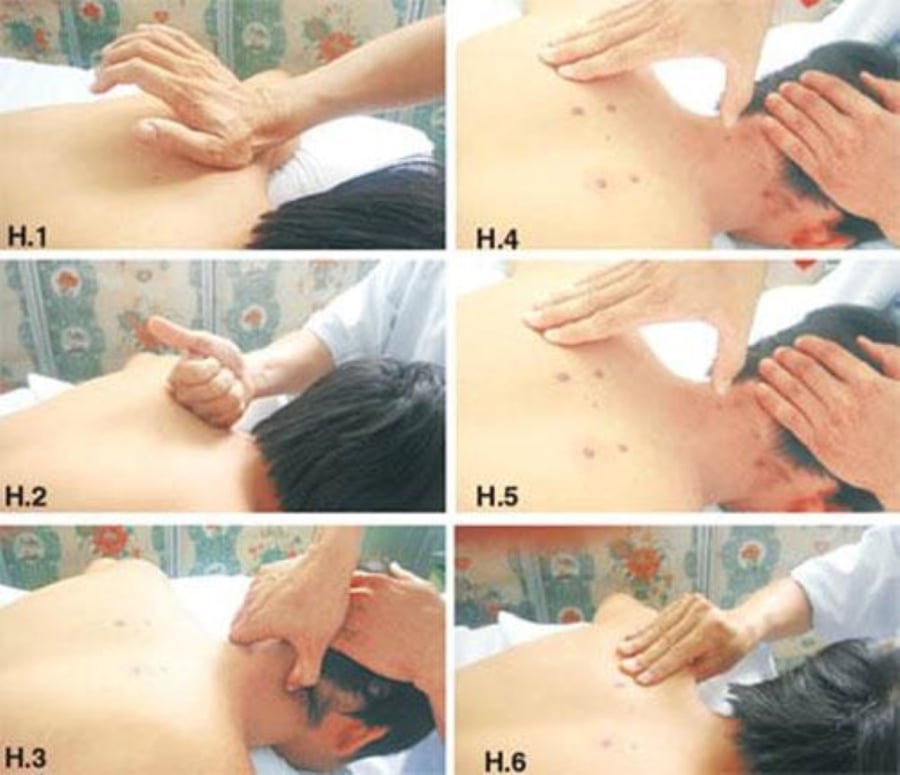 cach bam huyet chua dau vai gay