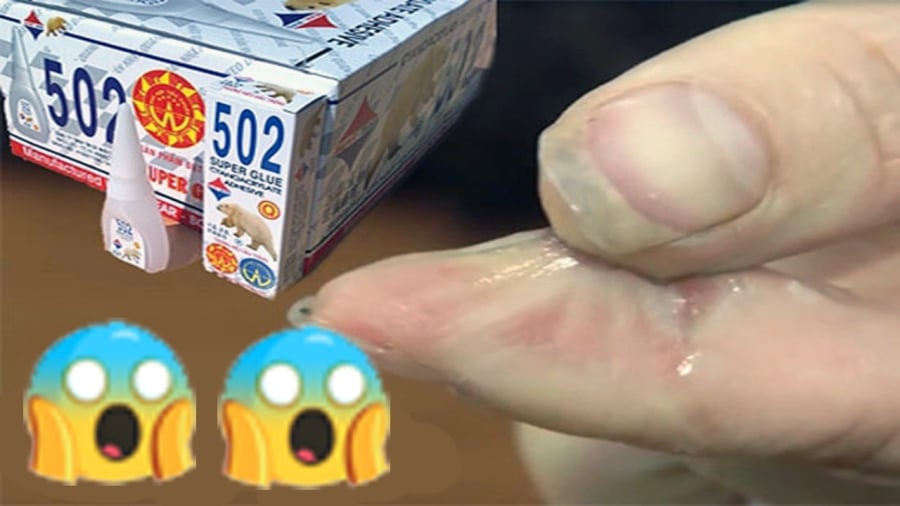 Cách gỡ keo 502 dính trên tay và đồ dùng nhanh nhất, không lo phồng rộp