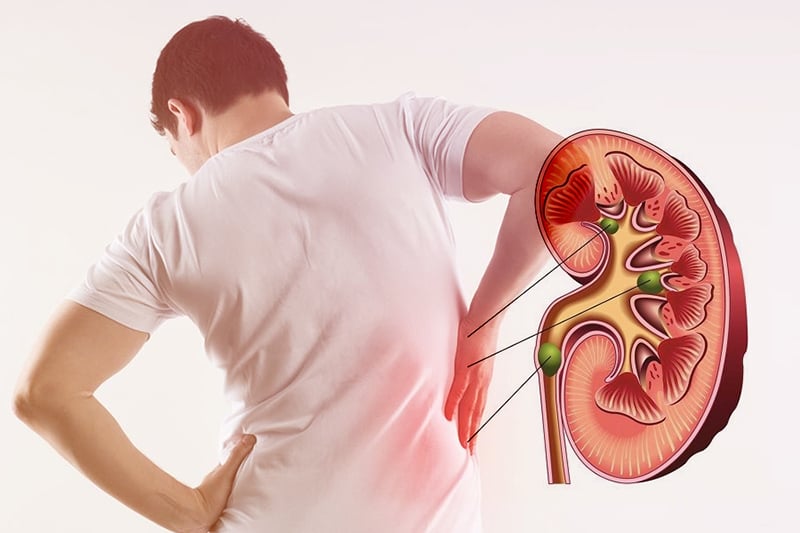 5 dấu hiệu cảnh báo bệnh thận sớm