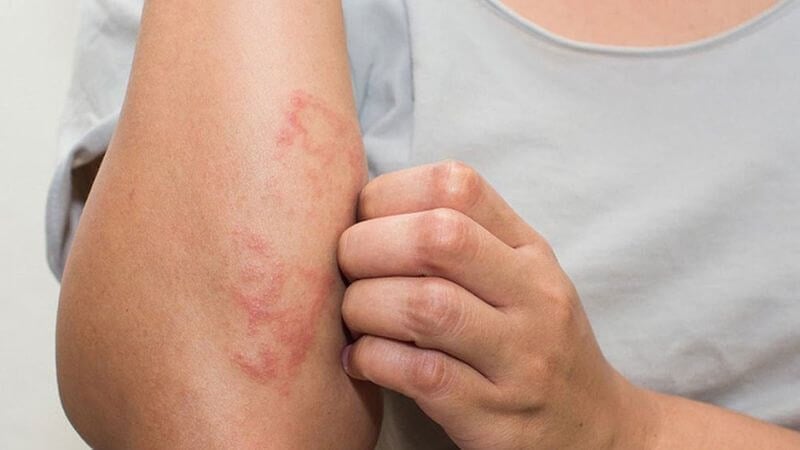 Cảnh báo dấu hiệu bệnh thận sớm