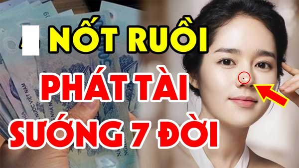 3 nốt ruồi phá tướng 