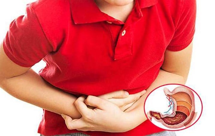 Cảnh báo bệnh dạ dày