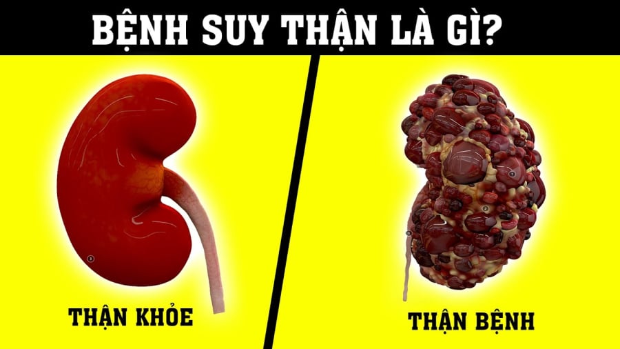 2 việc làm buổi tối trước khi ngủ cực kỳ hại thận: Nhiều người chạy thận vẫn không biết lý do