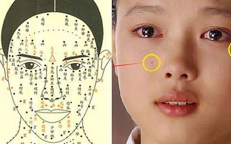 Nốt ruồi phát tài