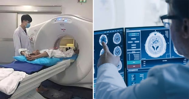 4 triệu chứng ung thư Gan giai đoạn 1-2, đến viện sớm còn cơ hội sống