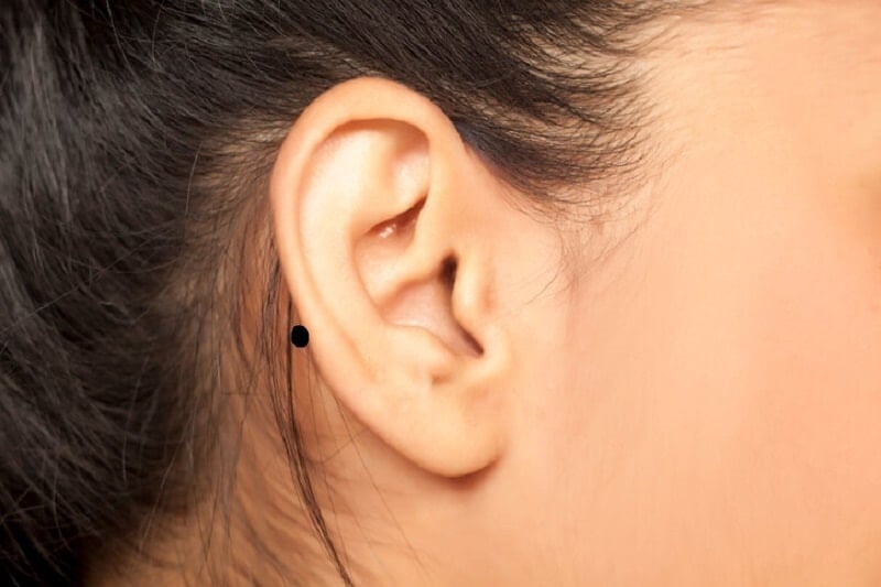 Phụ nữ có nốt ruồi ở sau tai