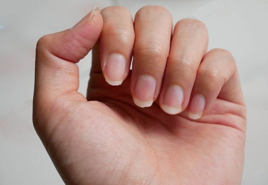 Nhìn móng tay bắt bệnh chính xác